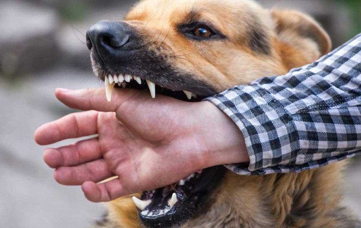 Dog Bite Injury Attorney Lawyer